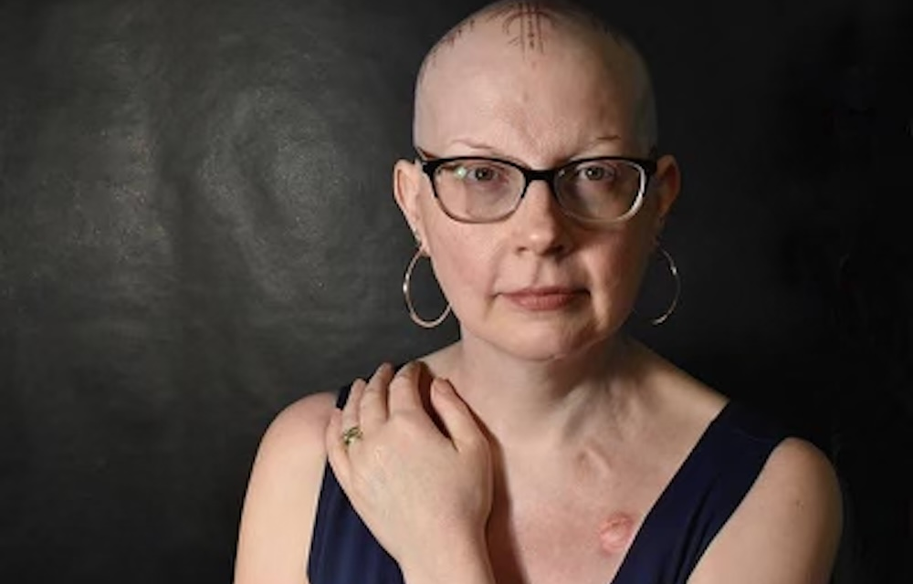 ‘I Was Diagnosed With Two Different Types of Breast Cancer at the Same Time (Yes, That Can Happen)’